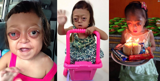 Disabled girl ..
